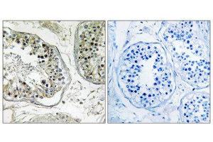 Immunohistochemistry (IHC) image for anti-Carbohydrate (Chondroitin 4) Sulfotransferase 13 (CHST13) (Internal Region) antibody (ABIN1850992) (CHST13 anticorps  (Internal Region))