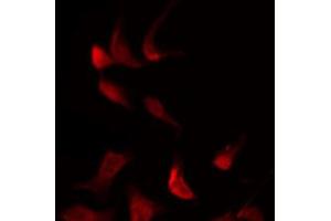 ABIN6269300 staining NIH-3T3 by IF/ICC.