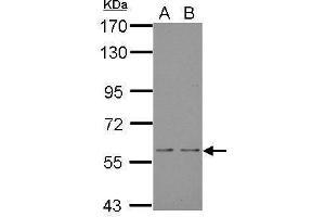 WB Image Sample (30 ug of whole cell lysate) A: JC B: BCL-1 7.