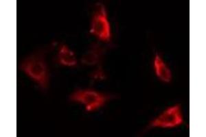 ABIN6275863 staining HepG2 cells by IF/ICC. (ACTBL2 anticorps  (Internal Region))