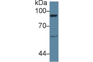 Western Blot; Sample: Rat Serum; Primary Ab: 1µg/ml Rabbit Anti-Rat AMPH Antibody Second Ab: 0. (VAV1 anticorps  (AA 426-696))