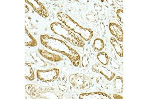Immunohistochemistry of paraffin-embedded human kidney using IDH1 Rabbit mAb (ABIN7268027) at dilution of 1:500 (40x lens). (IDH1 anticorps)