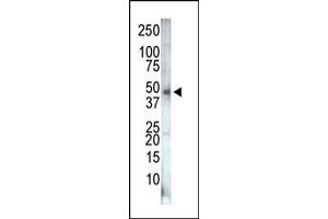 anti-PIP5K2 gamma (AA 333-364), (C-Term) antibody