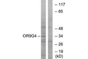 Western Blotting (WB) image for anti-Olfactory Receptor, Family 9, Subfamily G, Member 4 (OR9G4) (AA 278-327) antibody (ABIN2891063) (OR9G4 anticorps  (AA 278-327))