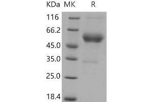 Western Blotting (WB) image for Activin A Receptor Type II-Like 1 (ACVRL1) (Active) protein (His tag,Fc Tag) (ABIN7194119)
