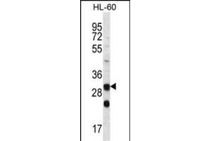 CA6 Antibody (C-term) (ABIN656592 and ABIN2845853) western blot analysis in HL-60 cell line lysates (35 μg/lane). (CA6 anticorps  (C-Term))