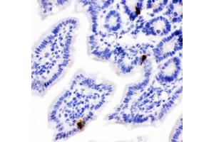 IHC testing of FFPE mouse intestine with PYY antibody.