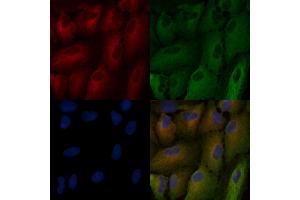 ABIN7094434 and ABIN7098482 staining  cells by IF/ICC. (FURIN anticorps  (N-Term))