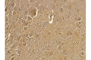 SNPH Mouse Monoclonal Antibody at 1/100 staining rat brain tissue by IHC-P. (Syntaphilin anticorps)