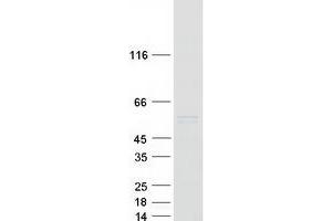 Validation with Western Blot