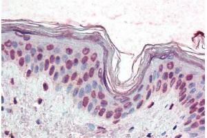 Human Skin (formalin-fixed, paraffin-embedded) stained with XBP1 antibody ABIN396972 at 10 ug/ml followed by biotinylated anti-mouse IgG secondary antibody ABIN481714, alkaline phosphatase-streptavidin and chromogen. (XBP1 anticorps  (AA 2-160))