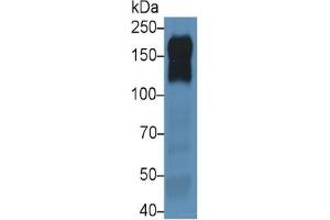 Mouse Capture antibody from the kit in WB with Positive Control: Sample Human A431 cell lysate;. (EGFR Kit ELISA)