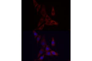 Immunofluorescence analysis of NIH/3T3 cells using  Rabbit pAb (ABIN3015826, ABIN3015827, ABIN3015828 and ABIN6219178) at dilution of 1:50 (40x lens).