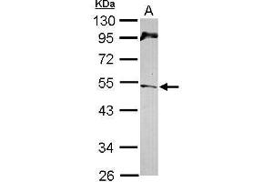 WB Image Sample (30 ug of whole cell lysate) A: NT2D1 10% SDS PAGE antibody diluted at 1:1000 (CHEK1 anticorps  (C-Term))