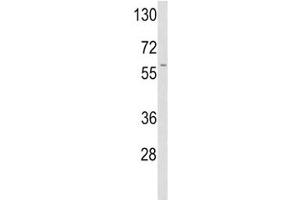 Western blot analysis of TPA antibody and A2058 lysate.