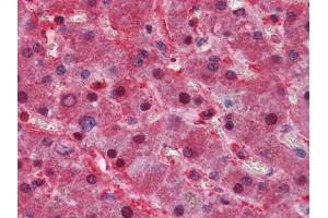 Immunohistochemical analysis of paraffin-embedded human Liver tissues using LPA antibody (Apo(a) anticorps)