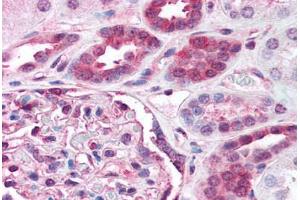 Human Kidney (formalin-fixed, paraffin-embedded) stained with RELA antibody ABIN218583 at 1:500 followed by biotinylated goat anti-rabbit IgG secondary antibody ABIN481713, alkaline phosphatase-streptavidin and chromogen.