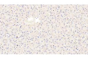 Detection of TRPA1 in Human Liver Tissue using Polyclonal Antibody to Transient Receptor Potential Cation Channel Subfamily A, Member 1 (TRPA1)
