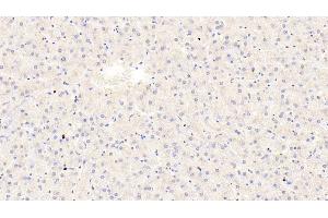 Detection of TRPA1 in Human Liver Tissue using Polyclonal Antibody to Transient Receptor Potential Cation Channel Subfamily A, Member 1 (TRPA1) (TRPA1 anticorps  (AA 63-370))