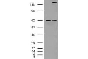 Image no. 2 for anti-Notch 1 (NOTCH1) (AA 2300-2556) antibody (ABIN1491241) (Notch1 anticorps  (AA 2300-2556))
