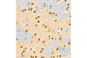 Immunohistochemistry of paraffin embedded rat brain using FGF11 (ABIN7073941) at dilution of 1:1100 (400x lens)