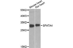 Western blot analysis of extracts of mouse heart and rat heart cell lines, using SPATA4 antibody. (SPATA4 anticorps)
