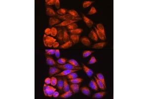 Immunofluorescence analysis of HeLa cells using ODF2 Rabbit pAb (ABIN7269128) at dilution of 1:100.