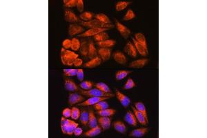 Immunofluorescence analysis of HeLa cells using ODF2 Rabbit pAb (ABIN7269128) at dilution of 1:100. (ODF2 anticorps  (AA 630-829))