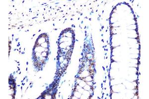 Immunohistochemistry of paraffin-embedded human colon using MB/MB/ML2 Rabbit mAb (ABIN1679325, ABIN3019109, ABIN3019110 and ABIN7101716) at dilution of 1:100 (40x lens). (MAD2L2 anticorps)