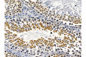 ABIN6264586 and ABIN6279745 at 1/100 staining rat testis tissue by IHC-P. (RAB5B anticorps  (C-Term))