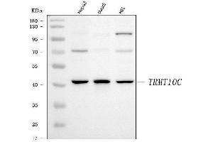 Western blot analysis of TRMT10C using anti-TRMT10C antibody (ABIN7601472).