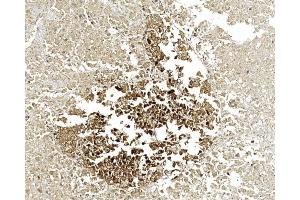 Immunohistochemical analysis of paraffin-embedded Human pancreas section using Pink1 (ABIN6244274 and ABIN6577058). (ENO2/NSE anticorps)