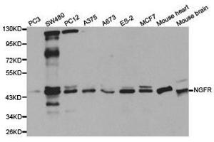 Western Blotting (WB) image for anti-Nerve Growth Factor Receptor (NGFR) antibody (ABIN1873905) (NGFR anticorps)