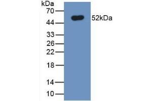 Detection of Recombinant FPN, Human using Monoclonal Antibody to Ferroportin (FPN) (SLC40A1 anticorps  (AA 127-321))