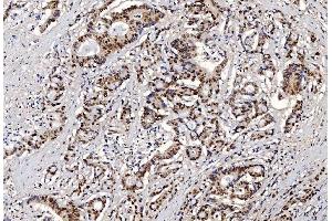 IHC analysis of FEN1 using anti-FEN1 antibody (ABIN7601618). (FEN1 anticorps  (AA 4-300))
