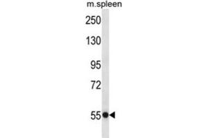 Western Blotting (WB) image for anti-Ubiquitin Specific Peptidase 40 (USP40) antibody (ABIN2997408) (USP40 anticorps)
