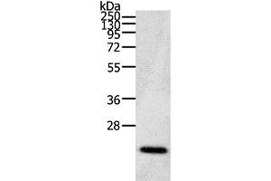 Western Blot analysis of Human fetal brain tissue using CDC42 Polyclonal Antibody at dilution of 1:200 (CDC42 anticorps)