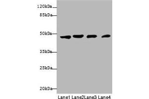 Western blot All lanes: KRT18 antibody at 12 μg/mL Lane 1: A431 whole cell lysate Lane 2: Hela whole cell lysate Lane 3: Jurkat whole cell lysate Lane 4: Zebrafish lysate Secondary Goat polyclonal to rabbit IgG at 1/10000 dilution Predicted band size: 49 kDa Observed band size: 49 kDa