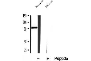 Western blot analysis of extracts of human placenta tissue, using Kindlin 2 antibody. (FERMT2 anticorps  (C-Term))