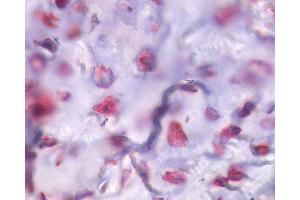 Anti-PTHR / PTHR1 antibody IHC of human bone, fractured callus. (PTH1R anticorps  (Internal Region))