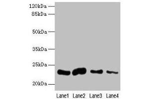Western blot All lanes: CLEC3A antibody at 0. (CLEC3A anticorps  (AA 23-197))