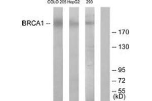 Western blot analysis of extracts from COLO205/HepG2 cells, treated with serum 20% 15', using BRCA1 (Ab-1524) Antibody. (BRCA1 anticorps  (AA 1491-1540))