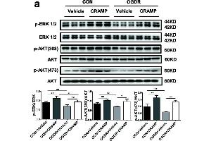 CRAMP reduces cardiomyocyte apoptosis via activating Akt and ERK1/2.