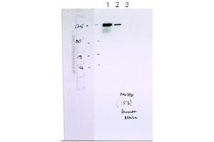 MSH6 antibody - N-terminal region  validated by WB using Human B cells and Mouse B cells at 0. (MSH6 anticorps  (N-Term))