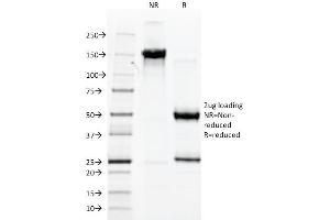 SDS-PAGE Analysis Purified vWF Mouse Monoclonal Antibody (3E2D10).