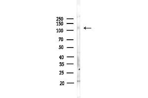 anti-Family with Sequence Similarity 65, Member B (FAM65B) antibody