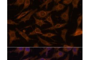 Immunofluorescence analysis of L929 cells using UCP1 Polyclonal Antibody at dilution of 1:100. (UCP1 anticorps)