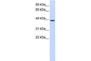 WB Suggested Anti-MOGAT2 Antibody Titration:  0. (MOGAT2 anticorps  (Middle Region))