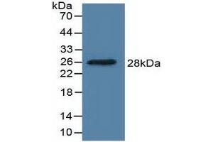 Detection of Recombinant DDAH1, Human using Polyclonal Antibody to Dimethylarginine Dimethylaminohydrolase 1 (DDAH1) (DDAH1 anticorps  (AA 20-215))