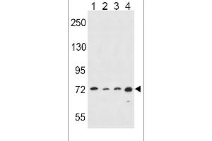 Western blot analysis in Hela(lane 1),A549(lane 2),K562(lane 3),MDA-MB435(lane 4) cell line lysates (35ug/lane). (ALOX15 anticorps  (C-Term))